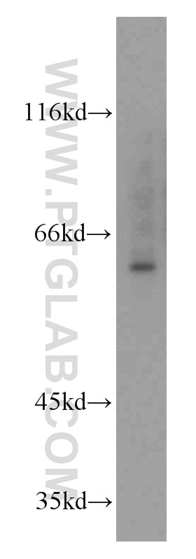 Western Blot (WB) analysis of mouse brain tissue using MTA3 Polyclonal antibody (14682-1-AP)