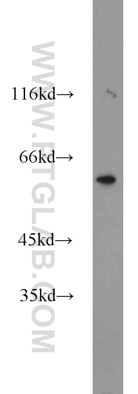 Western Blot (WB) analysis of mouse thymus tissue using MTA3 Polyclonal antibody (14682-1-AP)