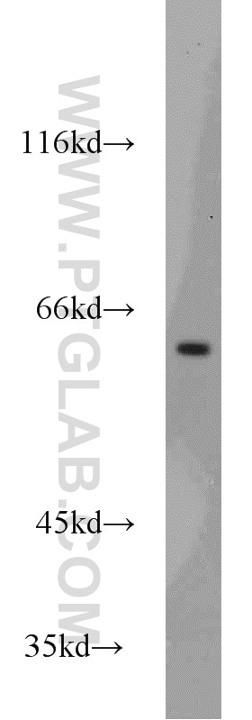 Western Blot (WB) analysis of Jurkat cells using MTA3 Polyclonal antibody (14682-1-AP)
