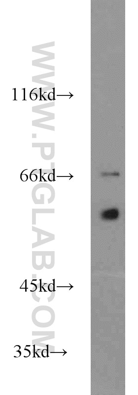 Western Blot (WB) analysis of MCF-7 cells using MTA3 Polyclonal antibody (14682-1-AP)