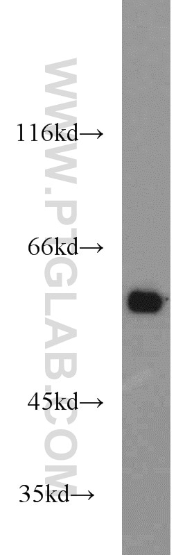 Western Blot (WB) analysis of MCF-7 cells using MTA3 Polyclonal antibody (14682-1-AP)