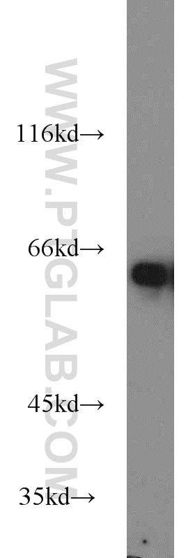 Western Blot (WB) analysis of Raji cells using MTA3 Polyclonal antibody (14682-1-AP)