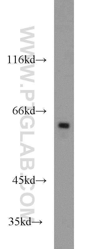 Western Blot (WB) analysis of Raji cells using MTA3 Polyclonal antibody (14682-1-AP)