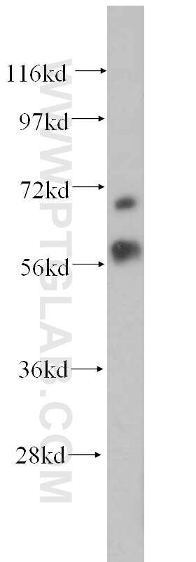 Western Blot (WB) analysis of HepG2 cells using MTA3 Polyclonal antibody (14682-1-AP)