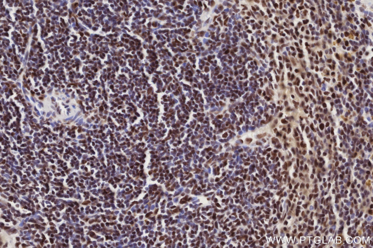 IHC staining of mouse spleen using 83042-3-RR Immunohistochemistry (IHC) staining of mouse spleen tissue using MTA3 Recombinant monoclonal antibody (83042-3-RR)