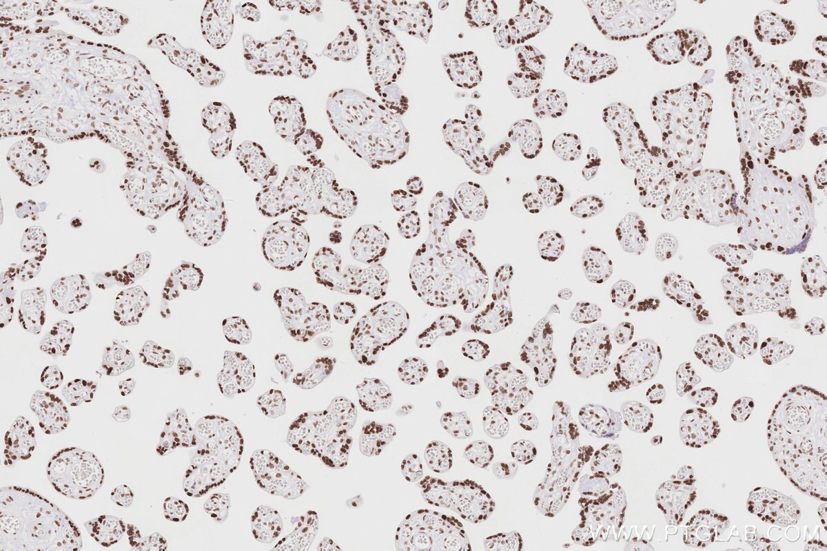 IHC staining of human placenta using 83042-3-RR Immunohistochemistry (IHC) staining of human placenta tissue using MTA3 Recombinant monoclonal antibody (83042-3-RR)