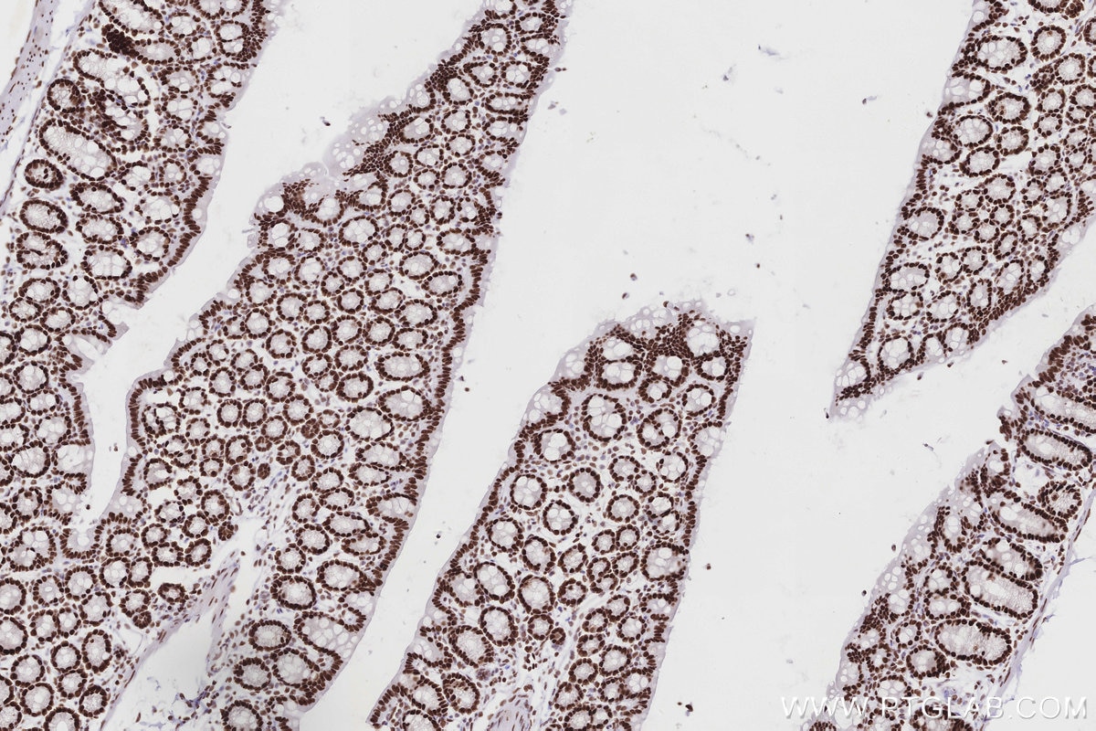 IHC staining of mouse colon using 83042-3-RR Immunohistochemistry (IHC) staining of mouse colon tissue using MTA3 Recombinant monoclonal antibody (83042-3-RR)