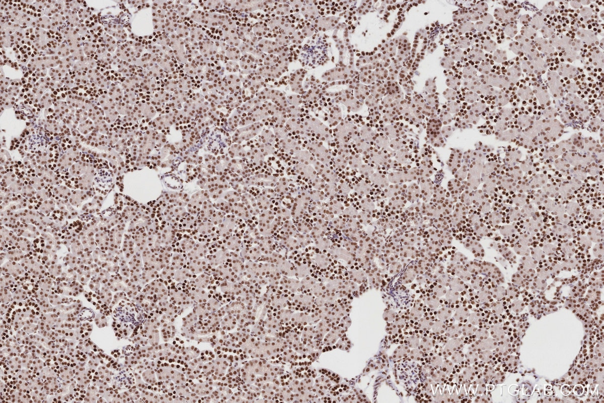 IHC staining of mouse kidney using 83042-3-RR Immunohistochemistry (IHC) staining of mouse kidney tissue using MTA3 Recombinant monoclonal antibody (83042-3-RR)
