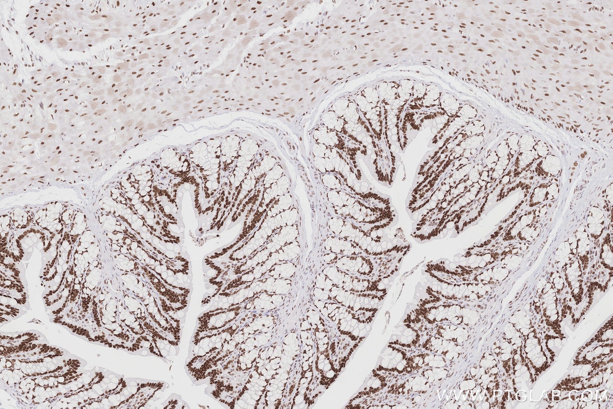 IHC staining of rat colon using 83042-3-RR Immunohistochemistry (IHC) staining of rat colon tissue using MTA3 Recombinant monoclonal antibody (83042-3-RR)