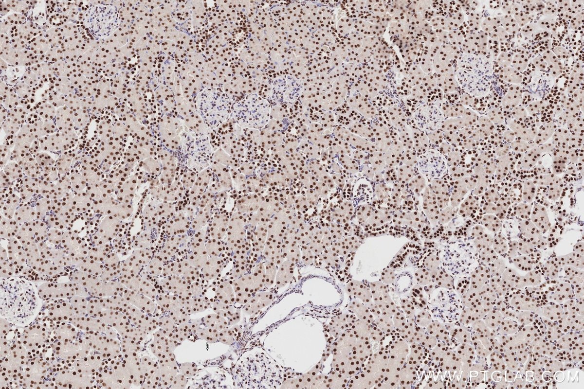 IHC staining of rat kidney using 83042-3-RR Immunohistochemistry (IHC) staining of rat kidney tissue using MTA3 Recombinant monoclonal antibody (83042-3-RR)