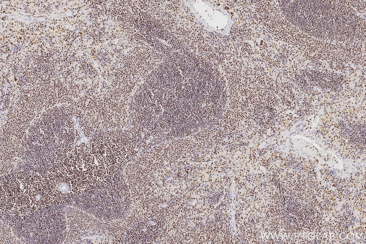 IHC staining of rat spleen using 83042-3-RR Immunohistochemistry (IHC) staining of rat spleen tissue using MTA3 Recombinant monoclonal antibody (83042-3-RR)