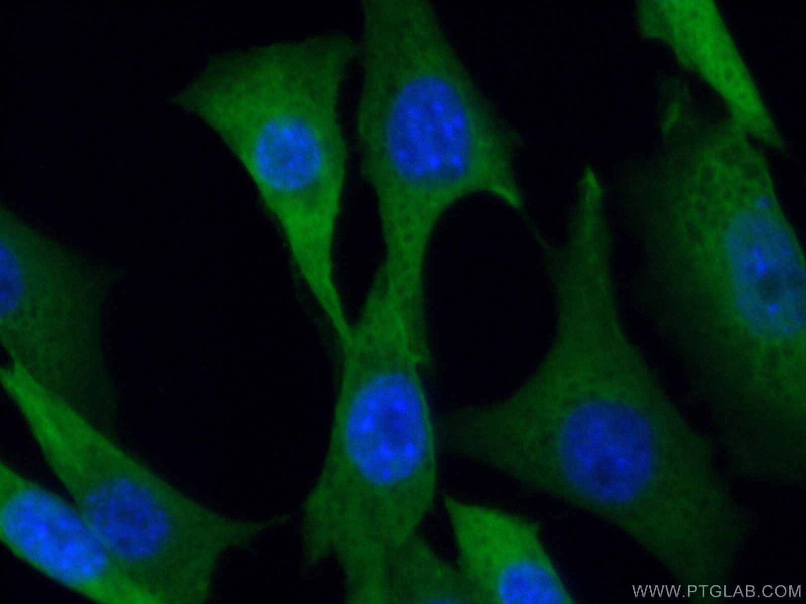 Immunofluorescence (IF) / fluorescent staining of NIH/3T3 cells using MTAP Polyclonal antibody (11475-1-AP)