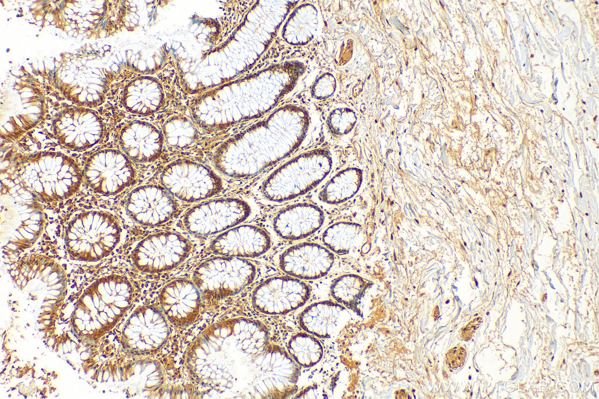 Immunohistochemistry (IHC) staining of human colon tissue using MTAP Polyclonal antibody (11475-1-AP)