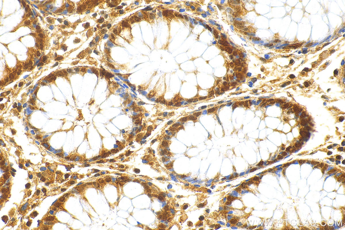 Immunohistochemistry (IHC) staining of human colon tissue using MTAP Polyclonal antibody (11475-1-AP)
