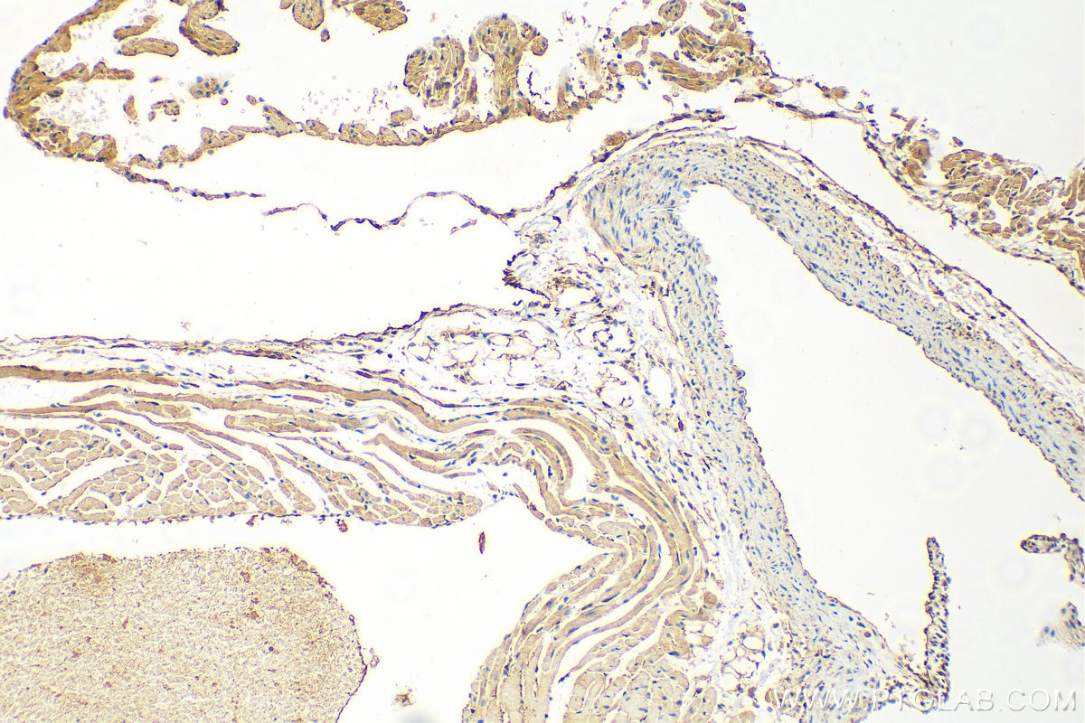 Immunohistochemistry (IHC) staining of mouse heart tissue using MTAP Polyclonal antibody (11475-1-AP)