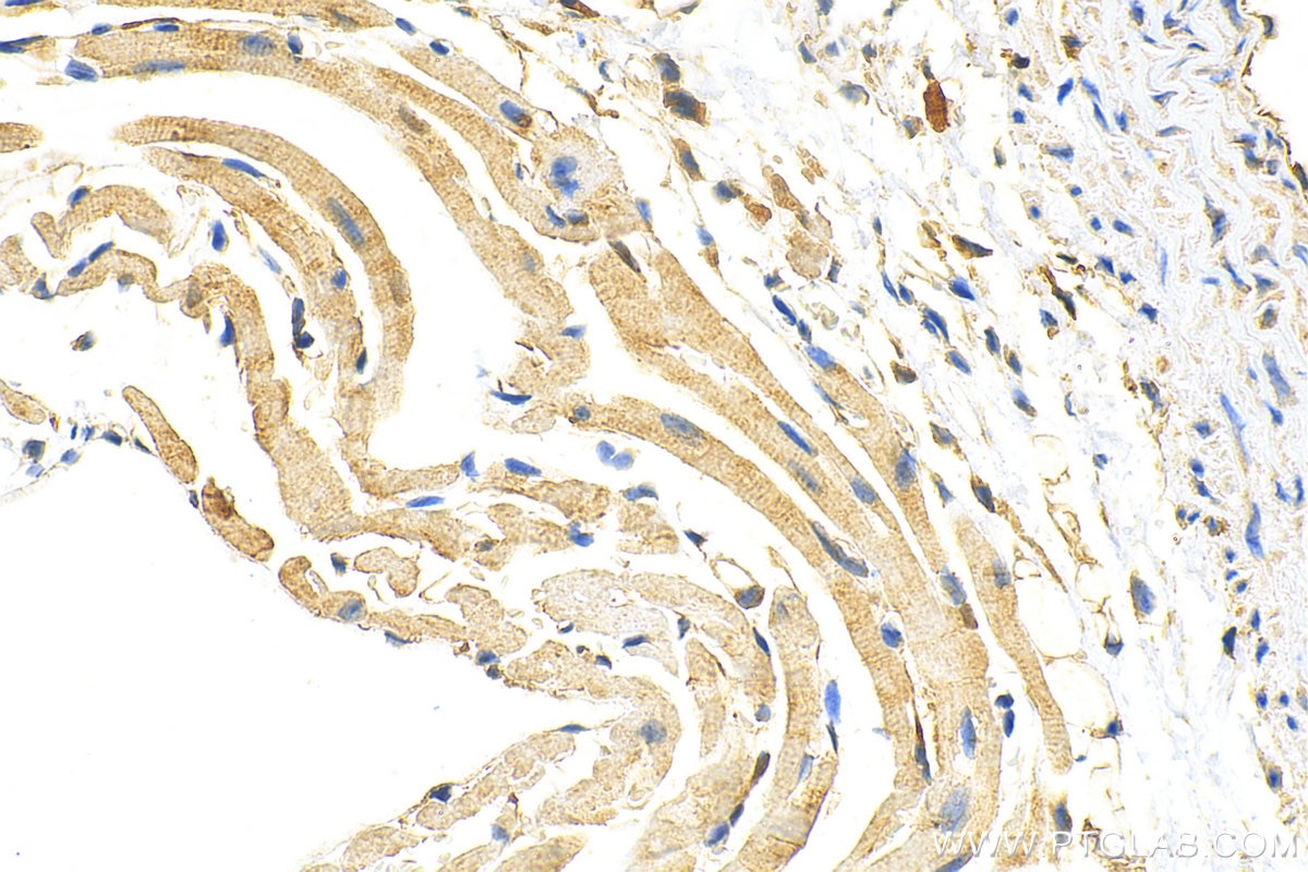 Immunohistochemistry (IHC) staining of mouse heart tissue using MTAP Polyclonal antibody (11475-1-AP)