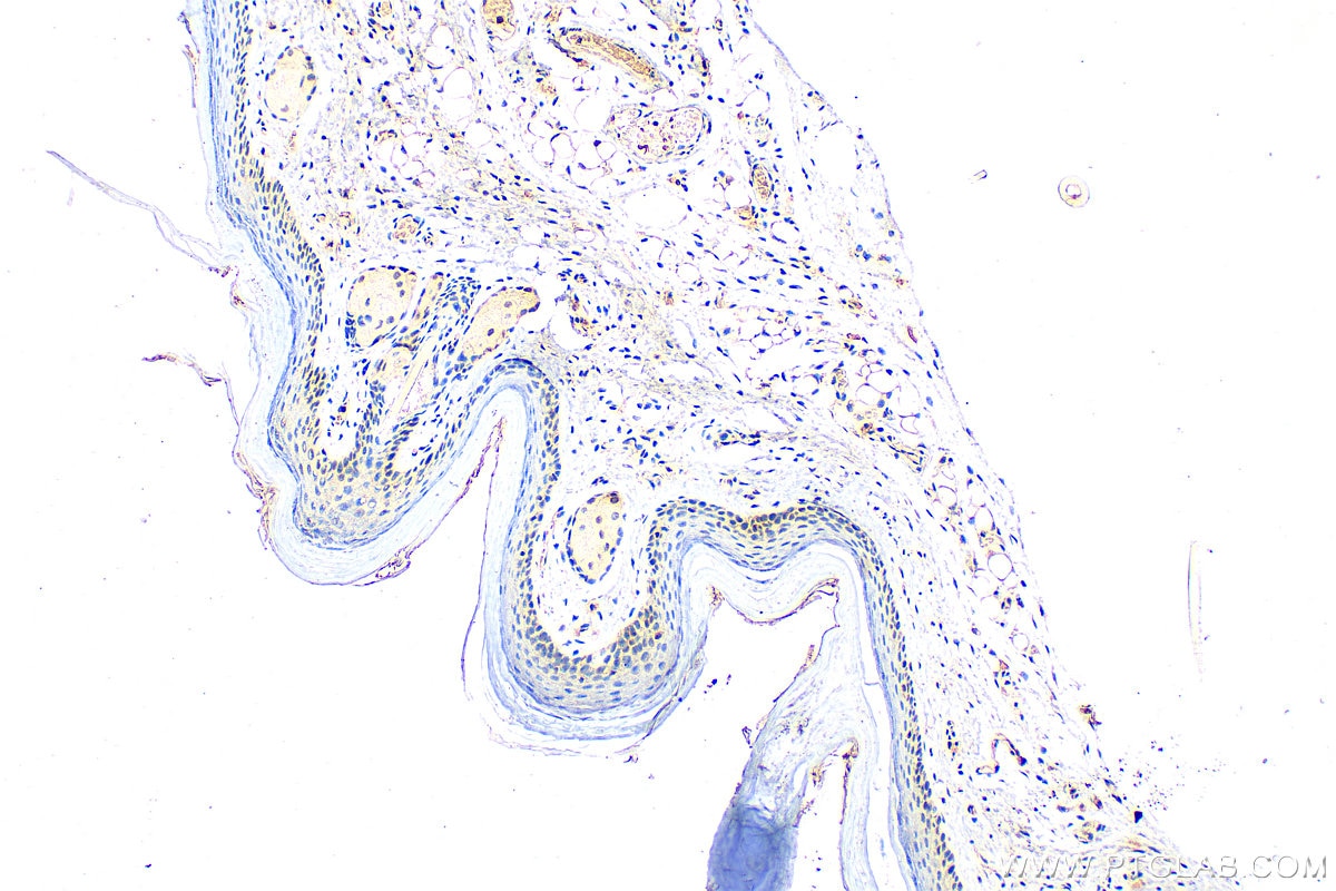 Immunohistochemistry (IHC) staining of mouse skin tissue using MTAP Polyclonal antibody (11475-1-AP)