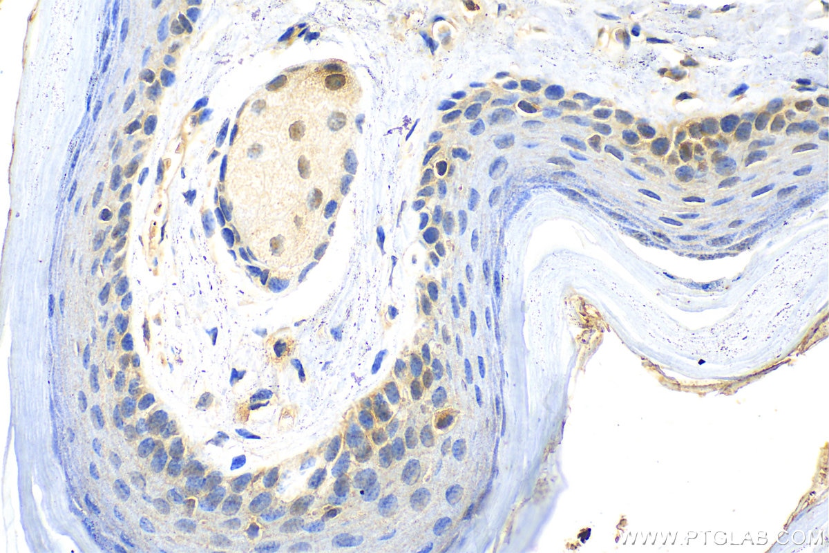 Immunohistochemistry (IHC) staining of mouse skin tissue using MTAP Polyclonal antibody (11475-1-AP)