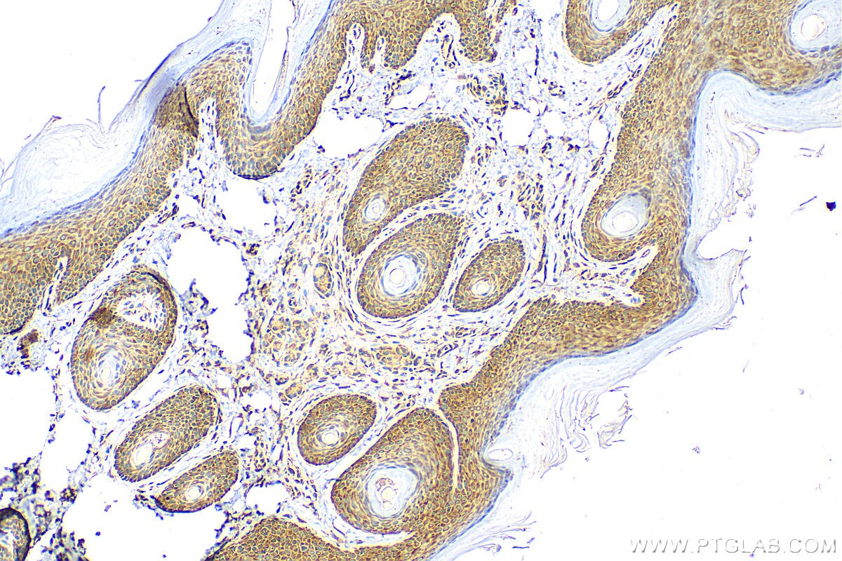 Immunohistochemistry (IHC) staining of rat skin tissue using MTAP Polyclonal antibody (11475-1-AP)