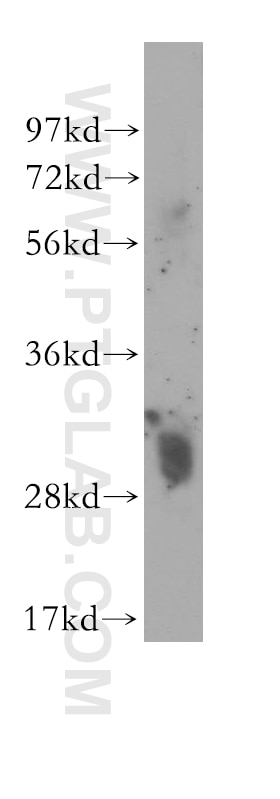 Western Blot (WB) analysis of human heart tissue using MTAP Polyclonal antibody (11475-1-AP)