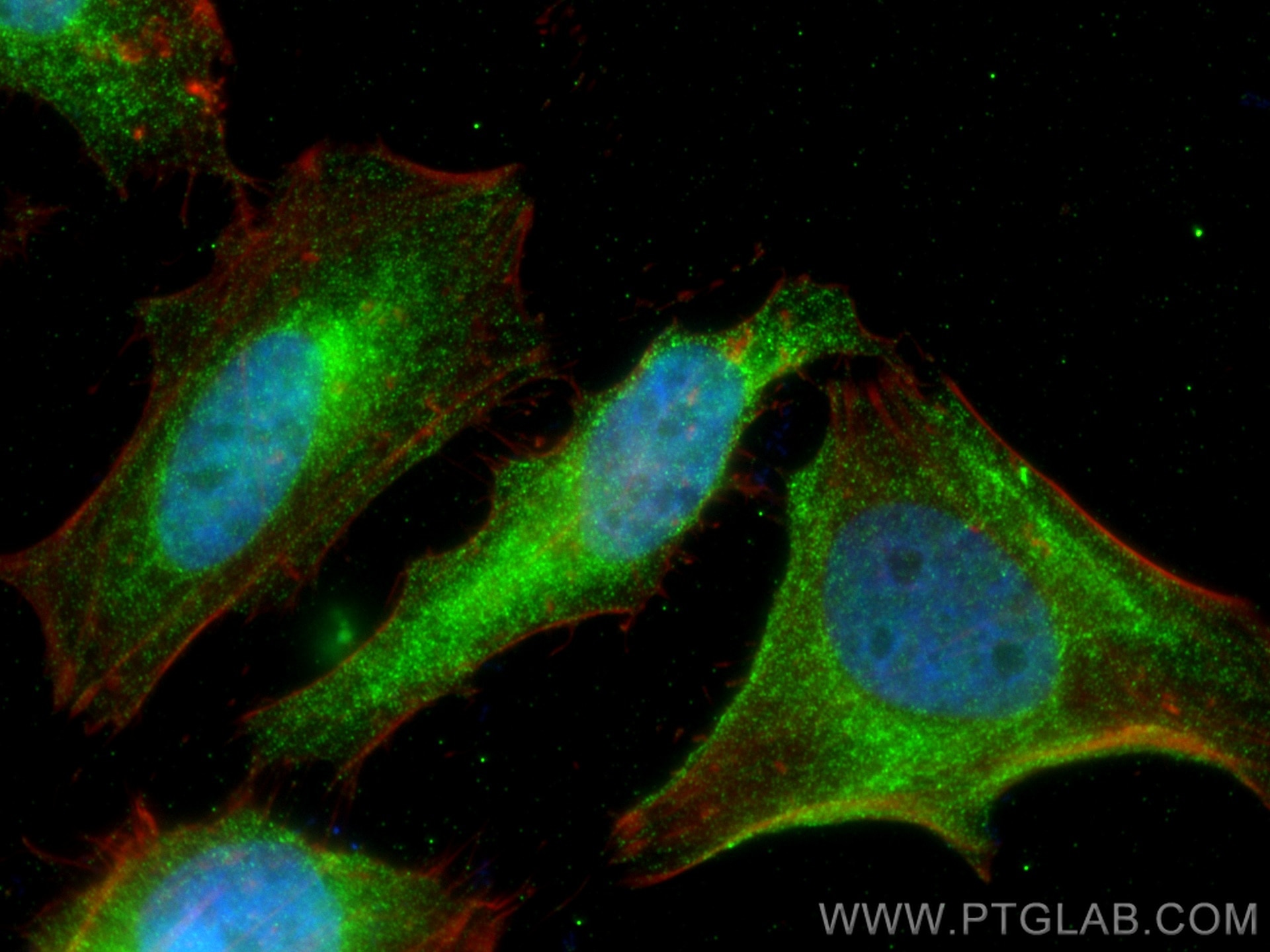 Immunofluorescence (IF) / fluorescent staining of HeLa cells using MTAP Monoclonal antibody (66706-1-Ig)