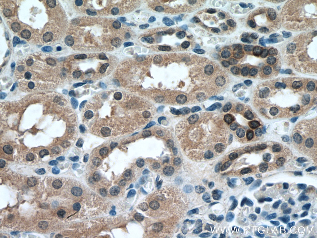 Immunohistochemistry (IHC) staining of human kidney tissue using MTAP Monoclonal antibody (66706-1-Ig)