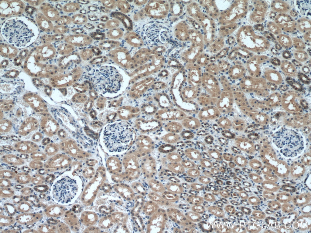 Immunohistochemistry (IHC) staining of human kidney tissue using MTAP Monoclonal antibody (66706-1-Ig)