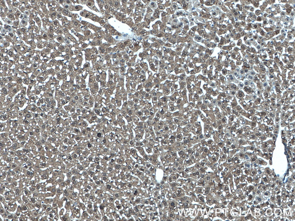 IHC staining of mouse liver using 66706-1-Ig