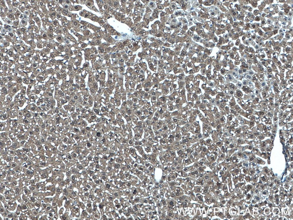 Immunohistochemistry (IHC) staining of mouse liver tissue using MTAP Monoclonal antibody (66706-1-Ig)