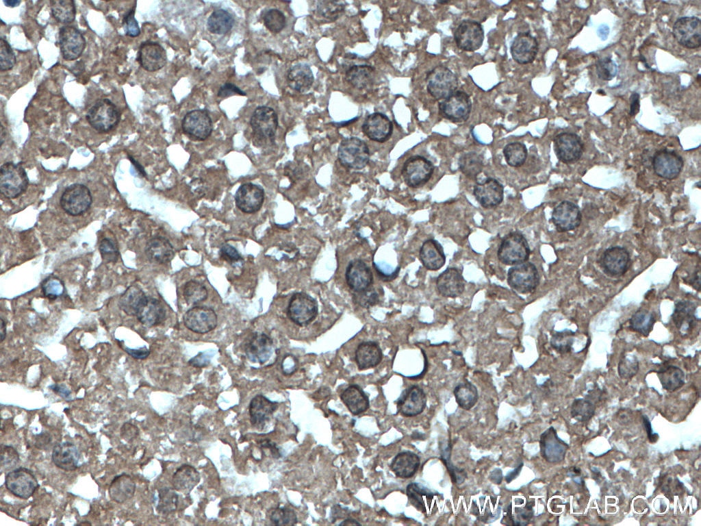 Immunohistochemistry (IHC) staining of mouse liver tissue using MTAP Monoclonal antibody (66706-1-Ig)