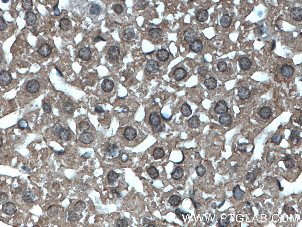 IHC staining of mouse liver using 66706-1-Ig