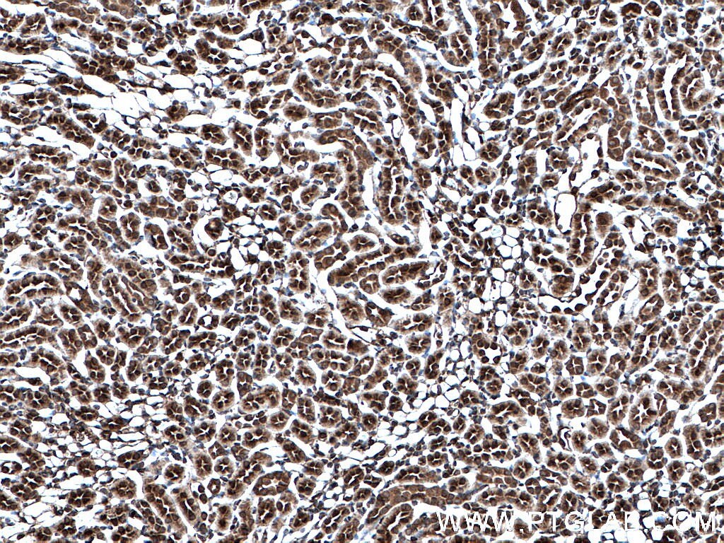 Immunohistochemistry (IHC) staining of mouse kidney tissue using MTAP Monoclonal antibody (66706-1-Ig)