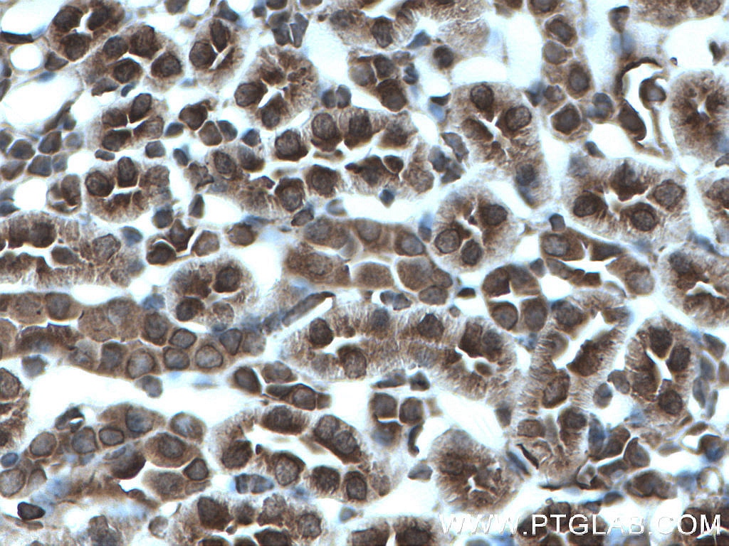 Immunohistochemistry (IHC) staining of mouse kidney tissue using MTAP Monoclonal antibody (66706-1-Ig)