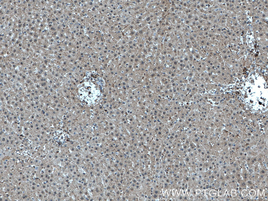 Immunohistochemistry (IHC) staining of rat liver tissue using MTAP Monoclonal antibody (66706-1-Ig)