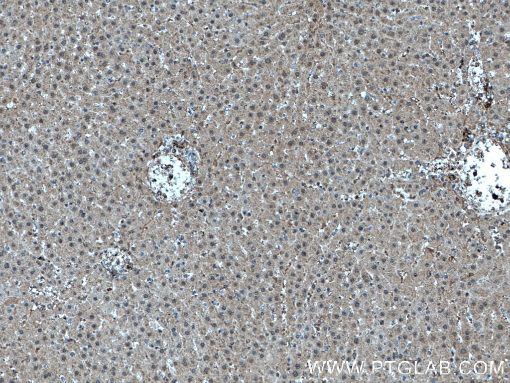 IHC staining of rat liver using 66706-1-Ig