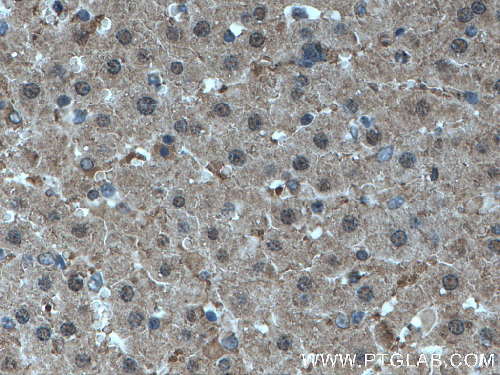IHC staining of rat liver using 66706-1-Ig