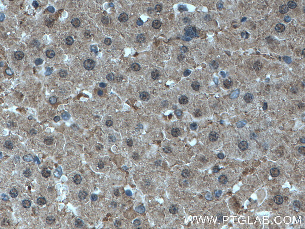 Immunohistochemistry (IHC) staining of rat liver tissue using MTAP Monoclonal antibody (66706-1-Ig)