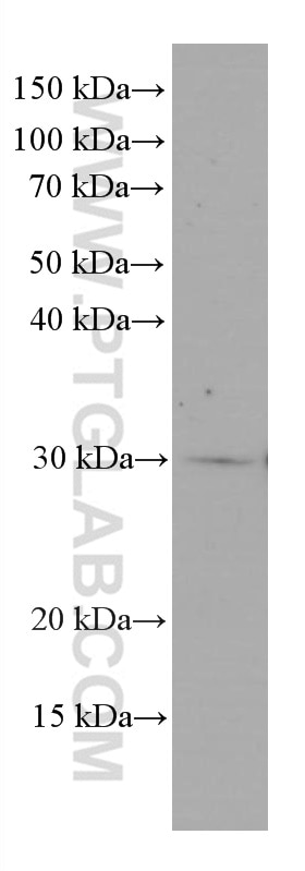 Western Blot (WB) analysis of Raji cells using MTAP Monoclonal antibody (66706-1-Ig)
