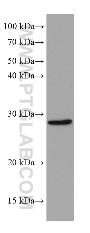 Western Blot (WB) analysis of HCT 116 cells using MTAP Monoclonal antibody (66706-1-Ig)