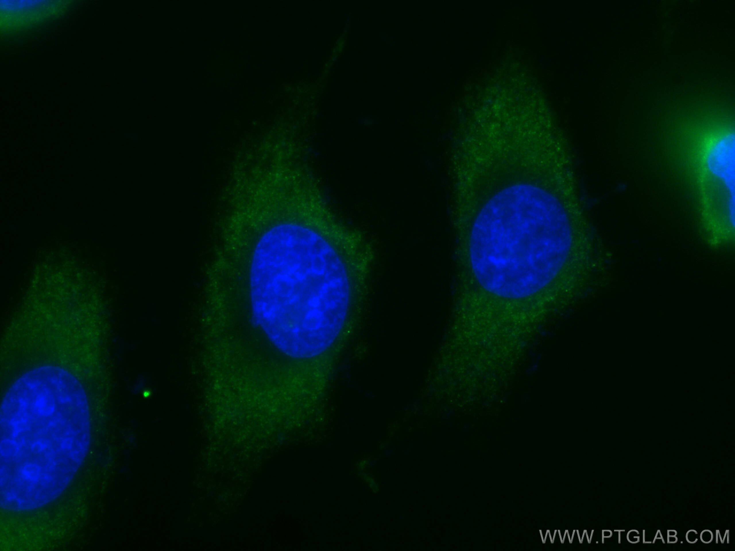 Immunofluorescence (IF) / fluorescent staining of HeLa cells using CoraLite® Plus 488-conjugated MTAP Monoclonal anti (CL488-66706)