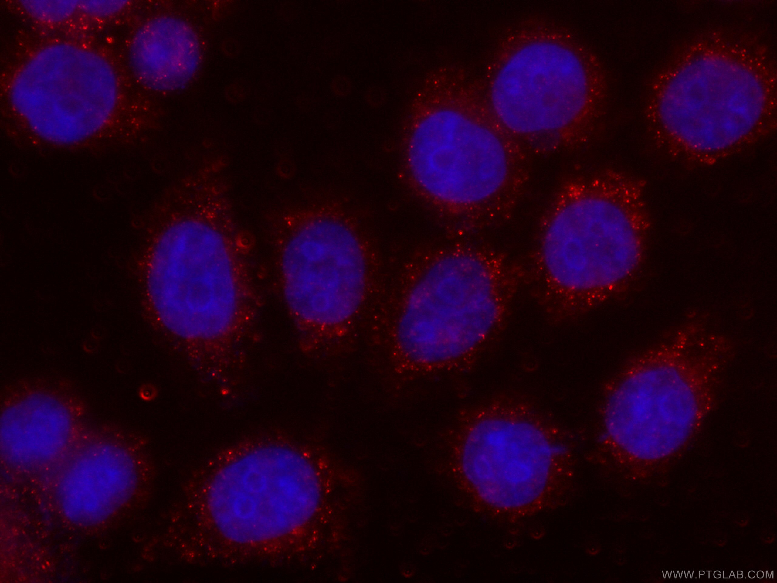 Immunofluorescence (IF) / fluorescent staining of HeLa cells using CoraLite®594-conjugated MTAP Monoclonal antibody (CL594-66706)