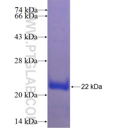 MTAP fusion protein Ag24475 SDS-PAGE