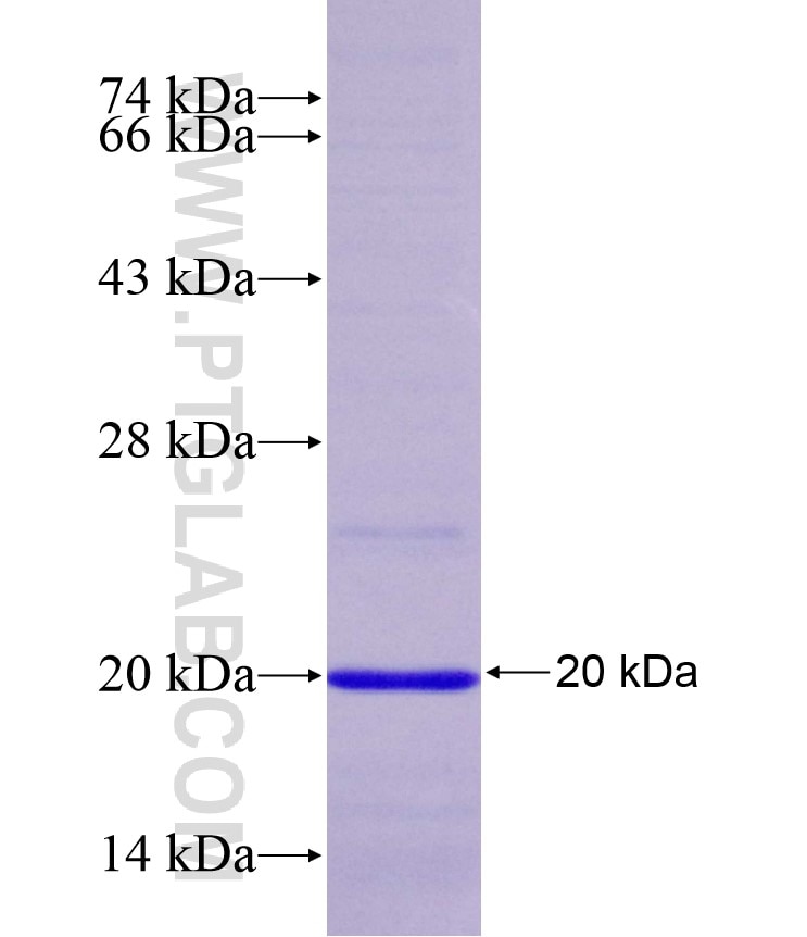 MTAP fusion protein Ag17954 SDS-PAGE