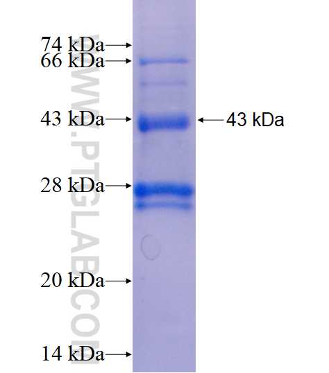 MTAP fusion protein Ag2051 SDS-PAGE