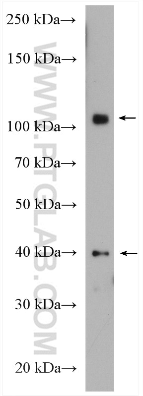 Western Blot (WB) analysis of U2OS cells using MTBP Polyclonal antibody (28356-1-AP)