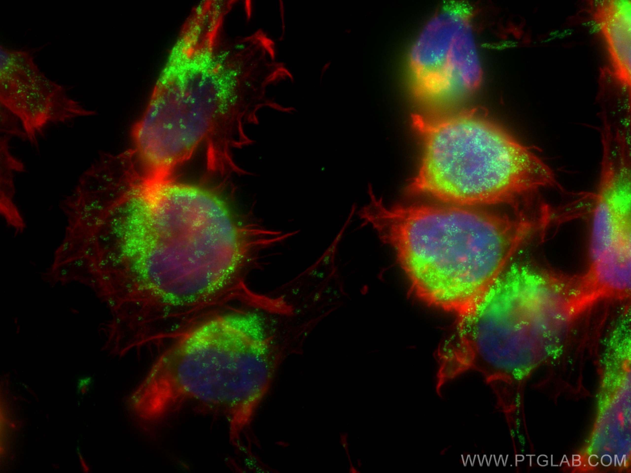 Immunofluorescence (IF) / fluorescent staining of U-251 cells using MTCH2 Polyclonal antibody (16888-1-AP)