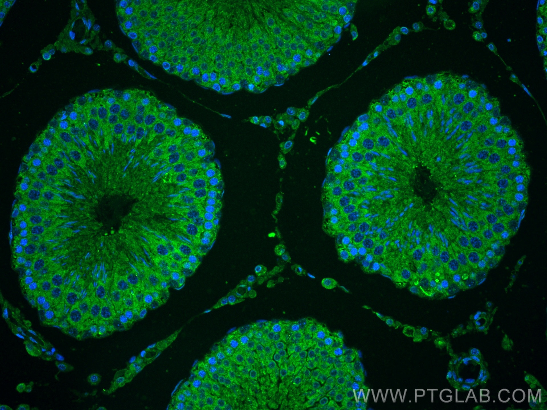 Immunofluorescence (IF) / fluorescent staining of rat testis tissue using MTCH2 Polyclonal antibody (16888-1-AP)