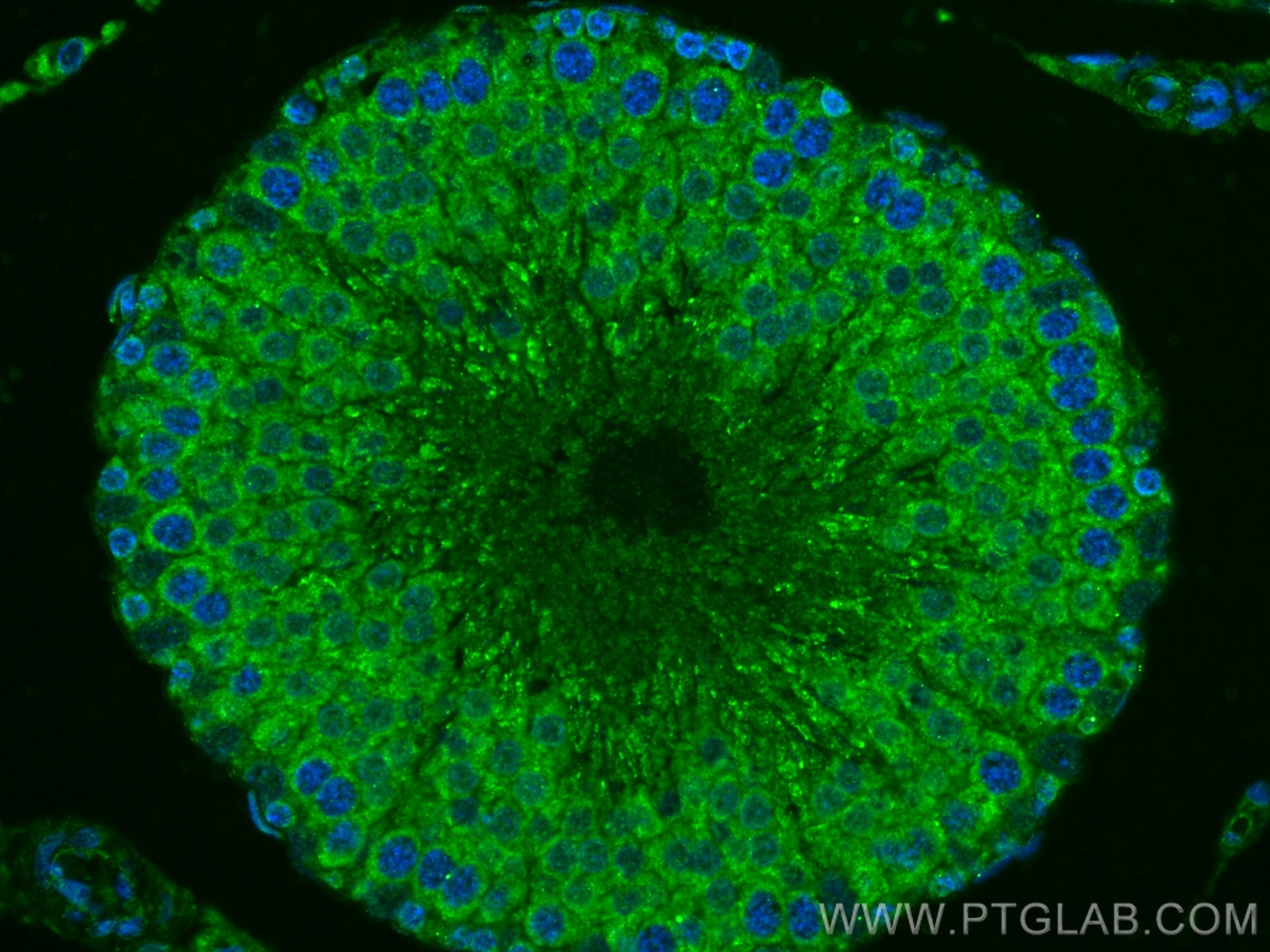Immunofluorescence (IF) / fluorescent staining of rat testis tissue using MTCH2 Polyclonal antibody (16888-1-AP)