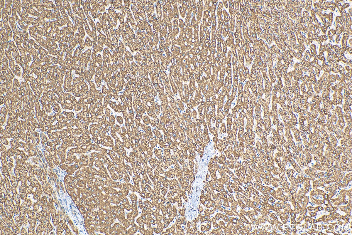 Immunohistochemistry (IHC) staining of human liver tissue using MTCH2 Polyclonal antibody (16888-1-AP)