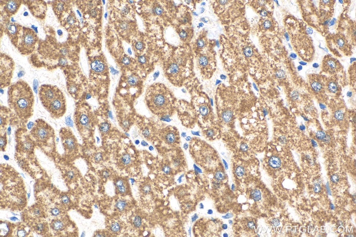 Immunohistochemistry (IHC) staining of human liver tissue using MTCH2 Polyclonal antibody (16888-1-AP)